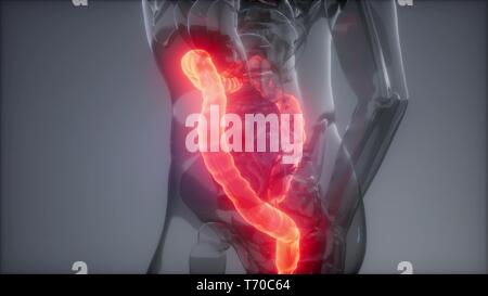 Colon umano esame radiologico Foto Stock