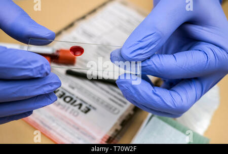 Polizia specializzata tenendo mostra il sangue nel supporto per microscopio per analizzare in laboratorio scientifico, immagine concettuale Foto Stock