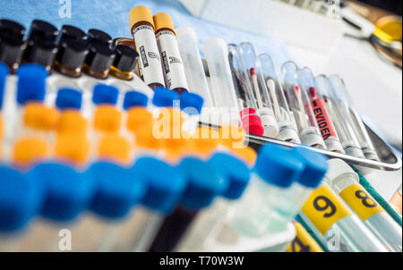 Diversi campioni di capelli e il sangue da analizzare in laboratorio scientifico, immagine concettuale Foto Stock