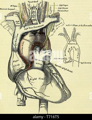 Illustrazione di anatomia dell'arco dell'Aorta e dei suoi rami, dal libro "Anatomia, descrittivo e l' intervento chirurgico da Henry Gray, Henry Vandyke Carter e John Guise Westmacott, 1860. La cortesia Internet Archive. () Foto Stock