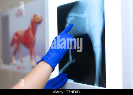 Un professionista medico radiologo con guanti è guardando un X-ray foto sullo sfondo di un negatoscopio che mostra una frattura del femore wi Foto Stock