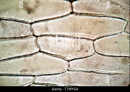 Vista microscopico di onion skin Foto Stock