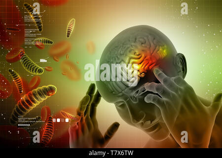 Testa di uomo che mostra il cervello umano con il mal di testa Foto Stock
