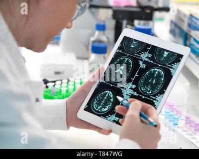 Visualizzazione medico paziente scansione cerebrale sulla tavoletta digitale in laboratorio Foto Stock