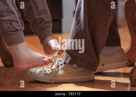 Donna con sindrome di catrame legatura di suo marito della calzatura con i suoi piedi Foto Stock