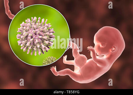 HIV infettare embrione umano, illustrazione Foto Stock