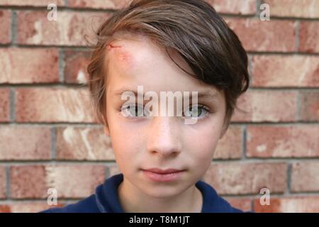 Primo piano del volto di un pelo corto bambino con grandi occhi verdi e un grosso livido e tagliati sulla fronte Foto Stock