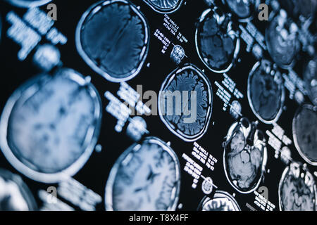 Immagini a risonanza magnetica della testa. Raggi X, MRI, cervello, medicina, la scienza Foto Stock