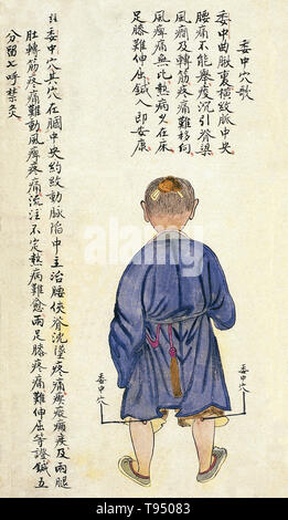 Acu-moxa punto grafico che mostra la weizhong (Centro dell'Uncino) punto, da Chuanwu lingji lu (Record di sovrana insegnamenti), da Zhang Youheng, un trattato di acu-moxa in due volumi. Questo lavoro sopravvive solo in un manoscritto bozza, completata nel 1869 (ottavo anno del regno Tongzhi periodo della dinastia Qing). Il punto weizhong è situato sul retro del ginocchio in mezzo al popliteo piega. Esso può essere cuciti a una profondità di 5 fen (1 fen [0,1 cun/cinese proporzionale pollice] = c. 0. Foto Stock