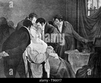 Guillaume Dupuytren operante su una cataratta. Il barone Guillaume Dupuytren (5 ottobre 1777 - 8 febbraio 1835) era un francese anatomista e chirurgo militare. Sebbene egli ha guadagnato molta stima per il trattamento di Napoleone Bonaparte emorroidi, egli è meglio conosciuto oggi per la sua descrizione di Dupuytren's contrattura che è chiamato dopo di lui e che egli azionata per la prima volta nel 1831 e pubblicato sulla rivista The Lancet nel 1834. Morì nel 1835 all'età di 57. Nessun artista accreditato non datato. Foto Stock