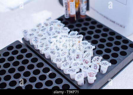 Recipienti di laboratorio con le analisi per la ricerca medica. Foto Stock