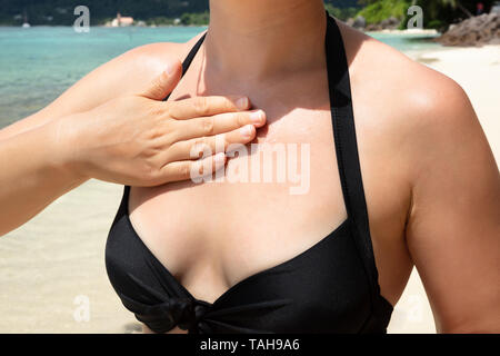 Close-up di una donna l'applicazione di crema di protezione solare sul suo corpo in spiaggia Foto Stock