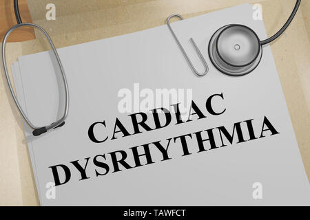 3D illustrazione di CARDIAC DYSRHYTHMIA titolo su un documento medico Foto Stock