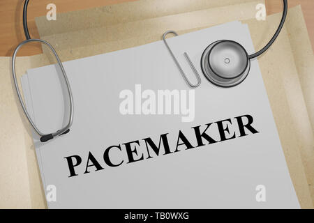 3D illustrazione del pacemaker titolo su un documento medico Foto Stock