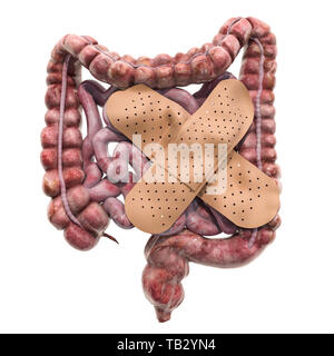 Intestino umano con fasce adesive. Il trattamento degli intestini concetto, 3D rendering isolati su sfondo bianco Foto Stock