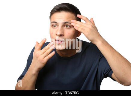 Ritratto di giovane uomo con acne problema su sfondo bianco Foto Stock