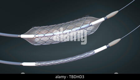 Sgonfiato e gonfiato a stent e cateteri a palloncino, illustrazione. Foto Stock