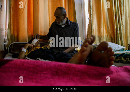 Beit Hanoun, Palestina. 2 giugno 2019 - 2 giugno 2019. Al Baraa Fayeq Ahmed al-Kafarneh, 11, riceve un trattamento medico in ospedale dopo essere stato ferito dai soldati israeliani sul confine venerdì proteste di Abu Safiya area nel nord della Striscia di Gaza. Â Il ragazzo ha perso il suo occhio immediatamente dopo essere stato colpito da un soldato israeliano con un proiettile di gomma e nonostante il trattamento ricevuto in un ospedale oftalmico di Gaza City. Secondo una relazione pubblicata dal 'Salva i bambini'' organizzazione alla fine dello scorso mese di marzo, a leastÂ 49Â i bambini hanno beenÂ ucciso a Gaza la recinzione di confine sin dall'inizio del GRE C Foto Stock