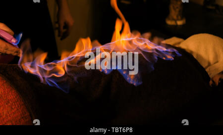 Incendio cinese massaggi e terapia Foto Stock