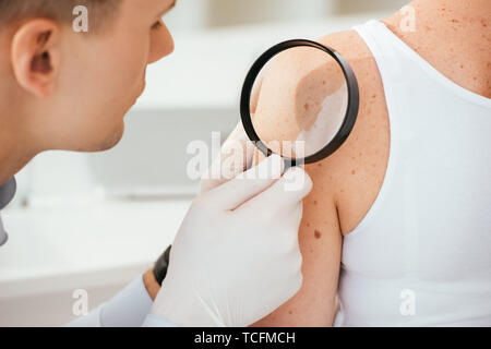 Il dermatologo in guanti in lattice tenendo la lente di ingrandimento mentre l'esame paziente con malattia della pelle Foto Stock