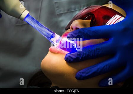 Dentista esaminando la bocca del paziente in esame dentale whitenening denti dentista con la strumentazione in clinica. Foto Stock