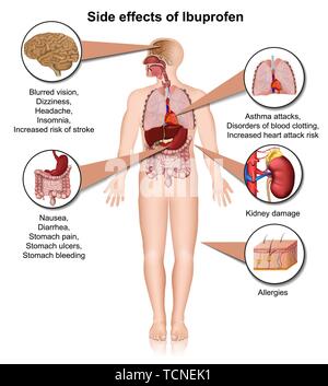 Gli effetti collaterali di ibuprofen 3d medical illustrazione vettoriale su sfondo bianco Illustrazione Vettoriale