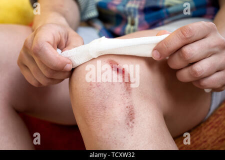 Rotto il ginocchio di spurgo con graffi profondi sulla pelle Foto Stock