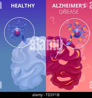 Il morbo di Alzheimer cervello set di banner. Cartoon illustrazione di alzheimer brain vector set di banner per il web design Illustrazione Vettoriale