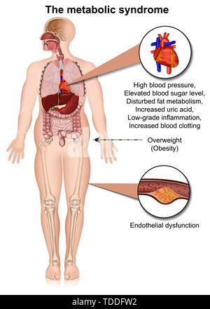 Il sistema metabolico medical illustrazione vettoriale isolati su sfondo bianco Una infografica Illustrazione Vettoriale