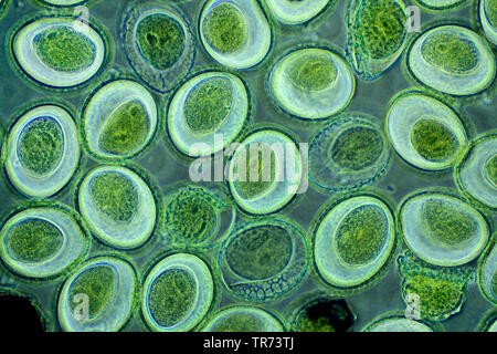 Lily (Lilium spec.), il polline di un giglio, un microscopio a contrasto di fase, x 100, Germania Foto Stock