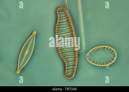 (Diatomee Diatomeae), diatomee in contrasto di fase e contrasto interferenziale x 160 Foto Stock