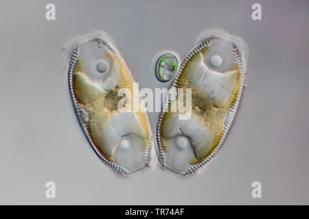 (Diatomee Diatomeae), vivente diatomee da ovest dell'Islanda, in Differential Interference Contrast, x 220, Islanda Foto Stock