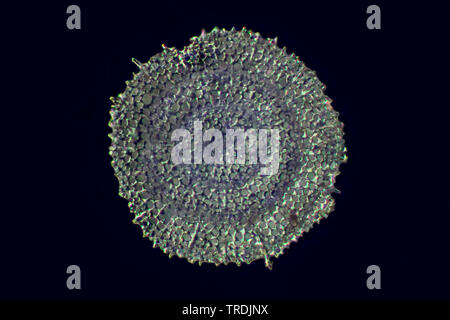 Radiolari (Radiolaria), radiolarian fossili ob Barbados island, 20 Foto Stock