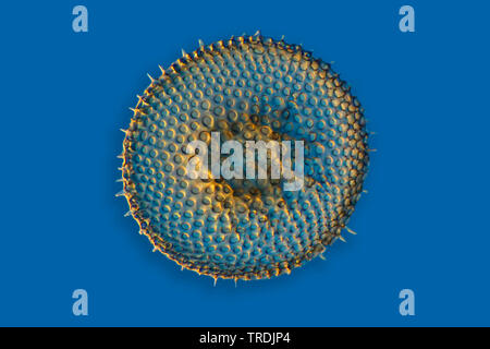 Radiolari (Radiolaria), radiolarian fossili ob Barbados isola con illuminazione a Rheinberg Foto Stock