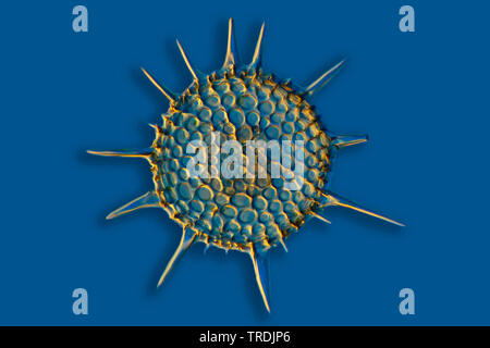 Radiolari (Radiolaria), radiolarian fossili ob Barbados isola con illuminazione a Rheinberg Foto Stock