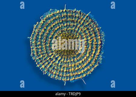 Radiolari (Radiolaria), radiolarian fossili ob Barbados isola con illuminazione a Rheinberg Foto Stock