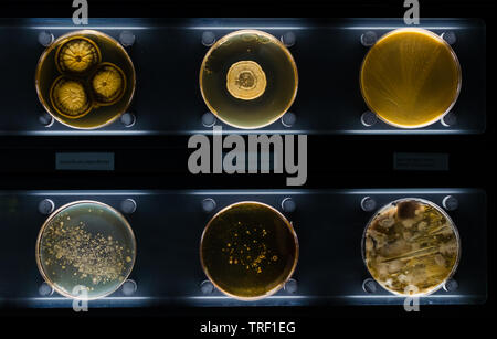 Diversi campioni con tipi di batteri che vivono in comune gli elementi di uso domestico- materasso, scarpa, crema idratante. Penicillium crateriforme. Foto Stock