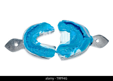 Due impronte dentali su uno sfondo bianco. Dental stampi dai collimatori mobili superiore e inferiore di materiale siliconico. L impronta del dente fila di alta pr Foto Stock