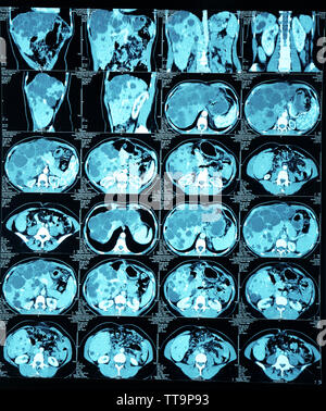 X-ray scanner di organi interni isolato su bianco Foto Stock