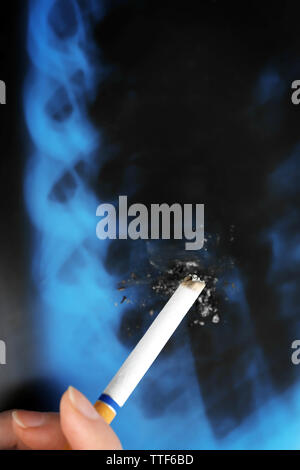 Femmina con mano sigaretta sui raggi x del polmone, close up Foto Stock