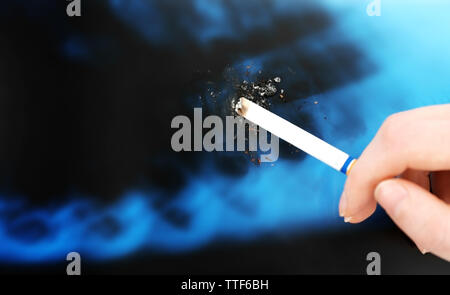 Femmina con mano sigaretta sui raggi x del polmone, close up Foto Stock