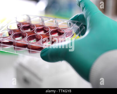 Ritagliate la mano dello scienziato azienda vassoio multipozzetto contenente cellule staminali durante il lavoro in laboratorio Foto Stock