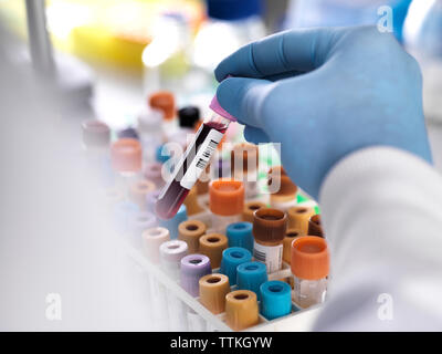 Ritagliate la mano del tecnico di laboratorio azienda campione di sangue per il test medici Foto Stock