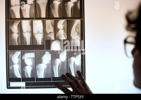 Immagine ritagliata della IFP esaminando immagine a raggi x in clinica Foto Stock