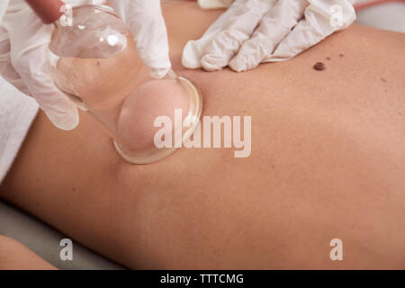 Tagliate le mani del medico donna di eseguire il massaggio Terapia cupping sul paziente presso la clinica medica Foto Stock