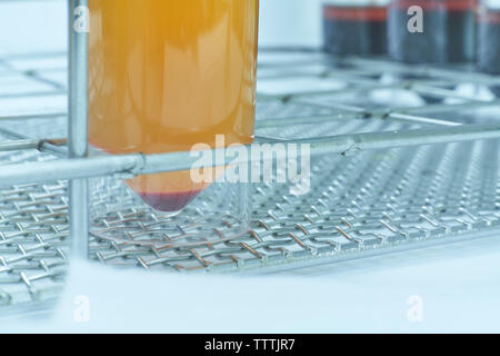 Il sangue in bottiglia di plastica, laboratorio dell'ospedale. Foto Stock