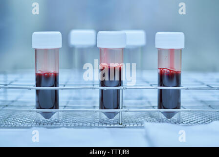 Il sangue in bottiglia di plastica, laboratorio dell'ospedale. Foto Stock