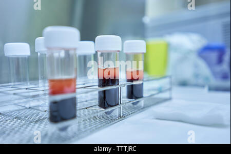 Il sangue in bottiglia di plastica, laboratorio dell'ospedale. Foto Stock