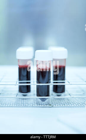 Il sangue in bottiglia di plastica, laboratorio dell'ospedale. Foto Stock