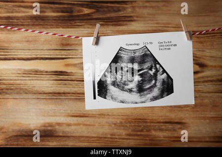 Ecografia dei baby appeso sulla corda Foto Stock